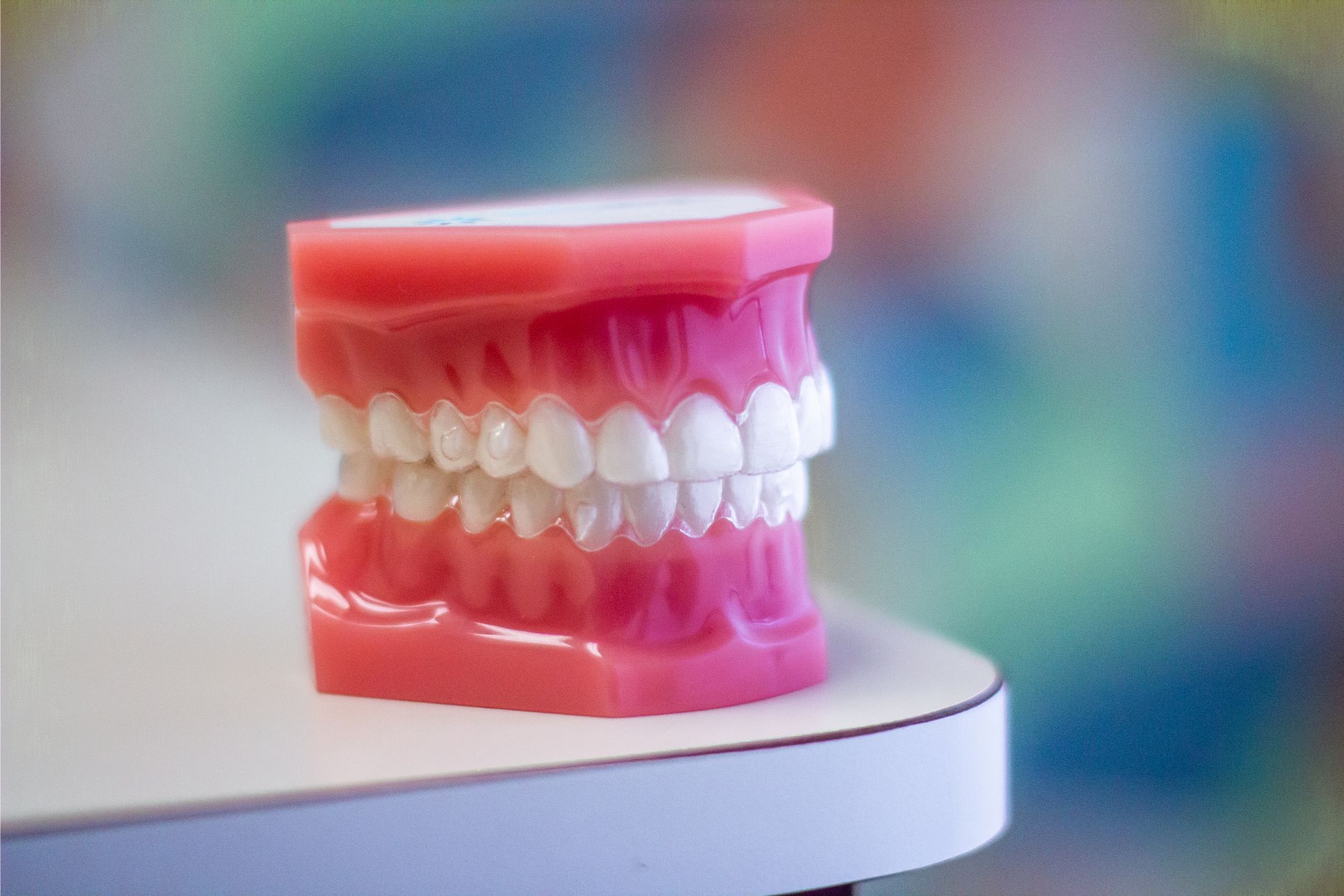 Clear Aligners